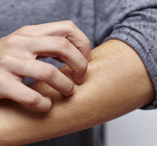 Mann kratzt sich am Arm